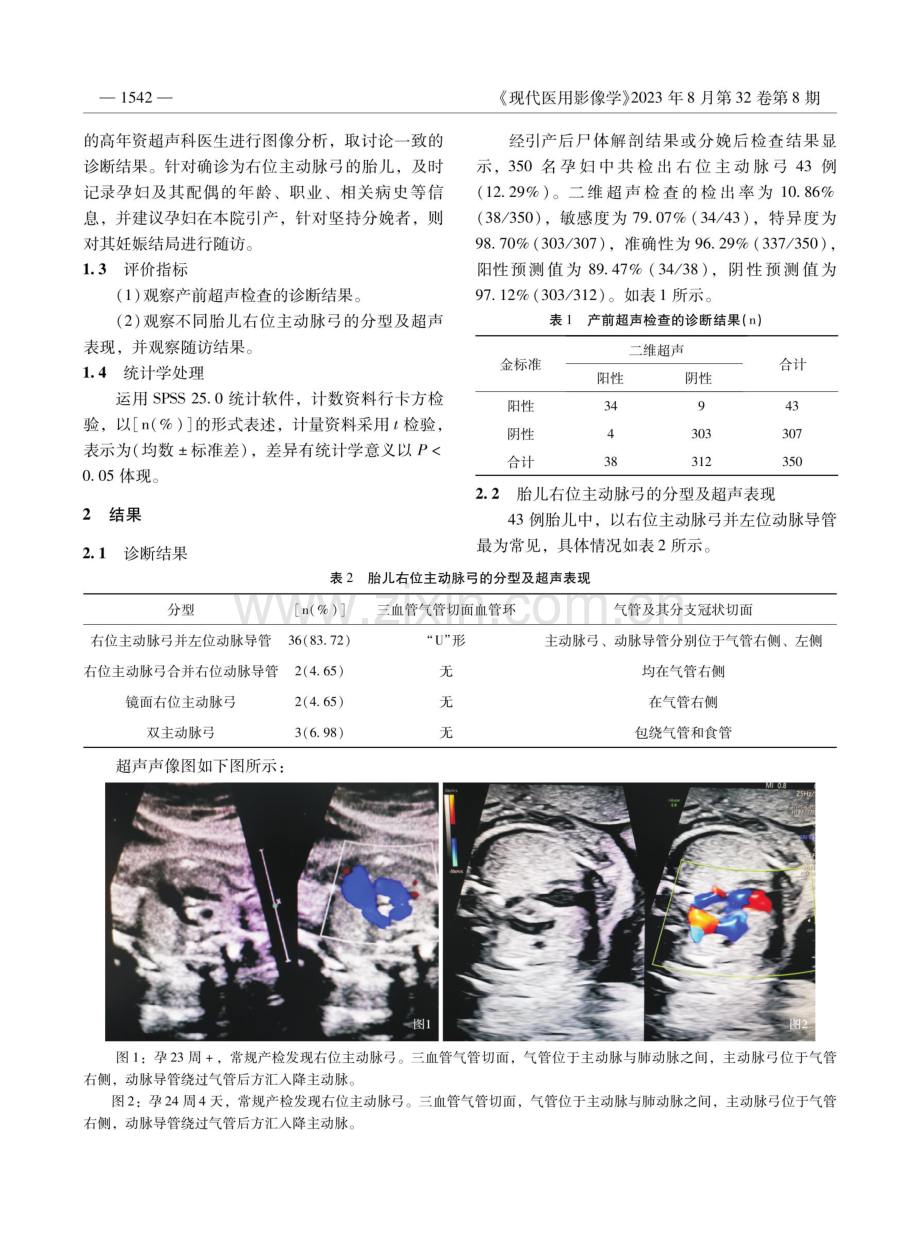 产前超声诊断胎儿右位主动脉弓的临床有效性探讨.pdf_第2页