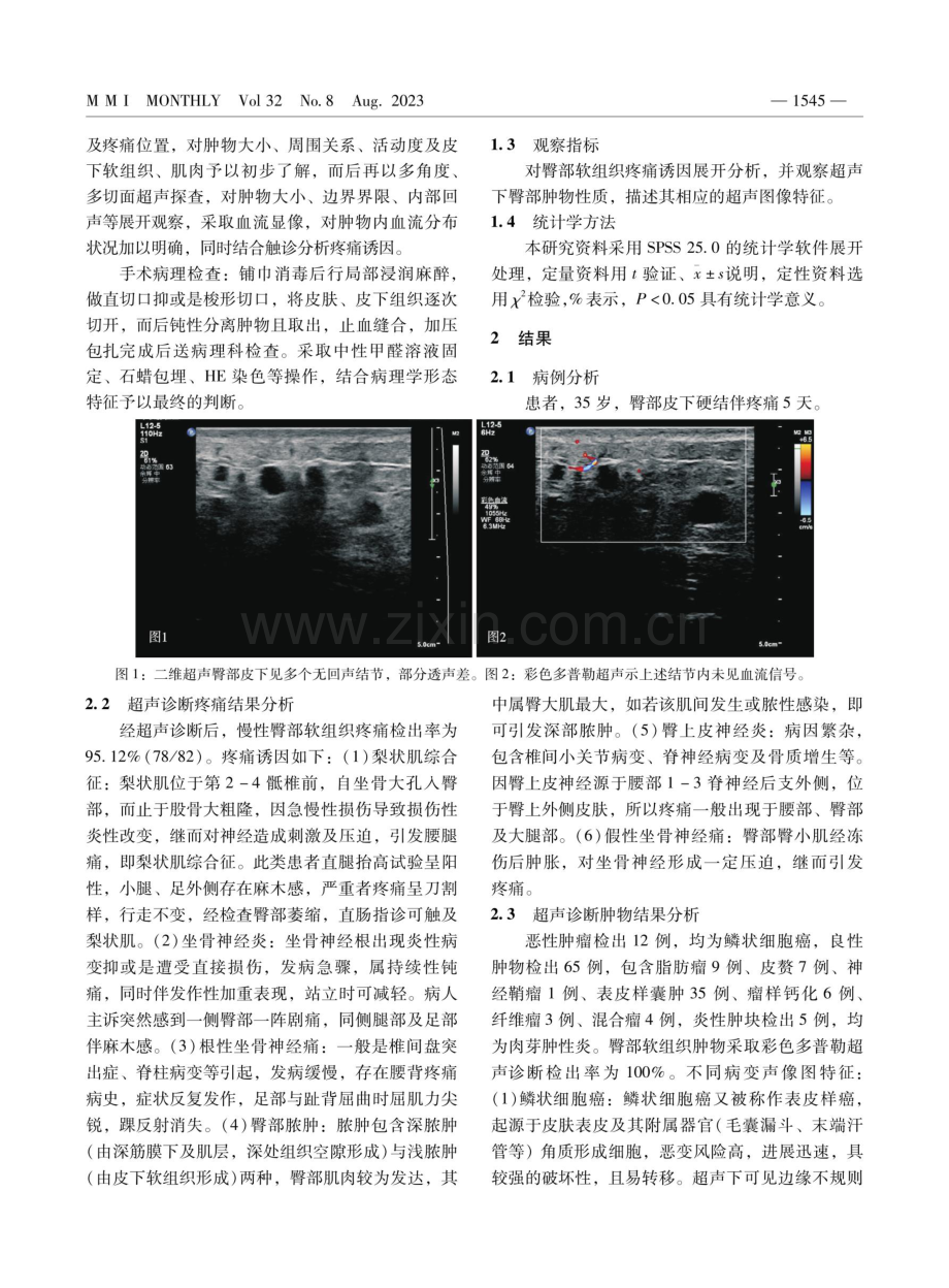 超声对慢性臀部软组织疼痛的诊断价值.pdf_第2页