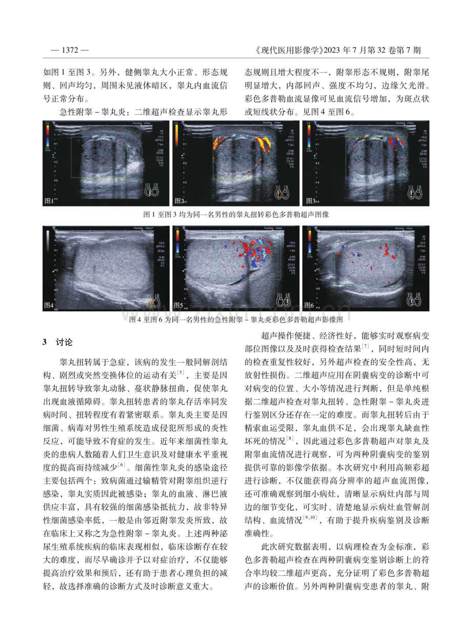 彩色多普勒超声在睾丸扭转与急性附睾-睾丸炎鉴别诊断中的应用价值.pdf_第3页