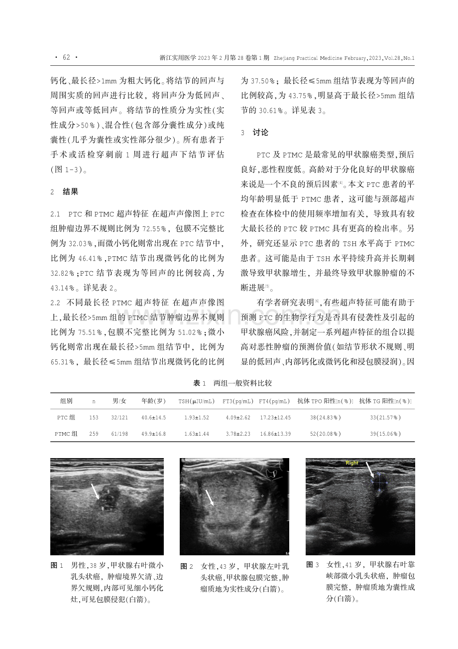 超声甲状腺乳头状癌和微小乳头状癌结节的鉴别诊断.pdf_第2页