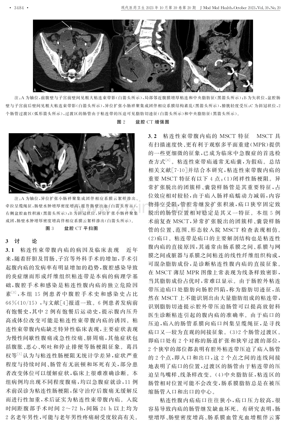 肠粘连束带腹内疝的多层螺旋CT特征及临床相关因素研究.pdf_第3页