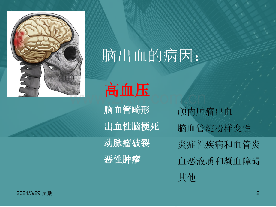 脑出血的MRI表现.ppt_第2页