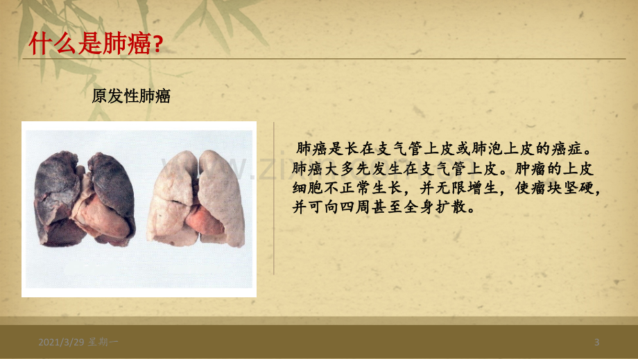 肺癌的护理常规.ppt_第3页