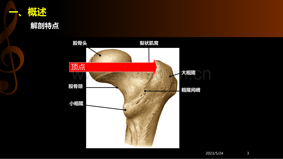 股骨粗隆间骨折.ppt_第3页