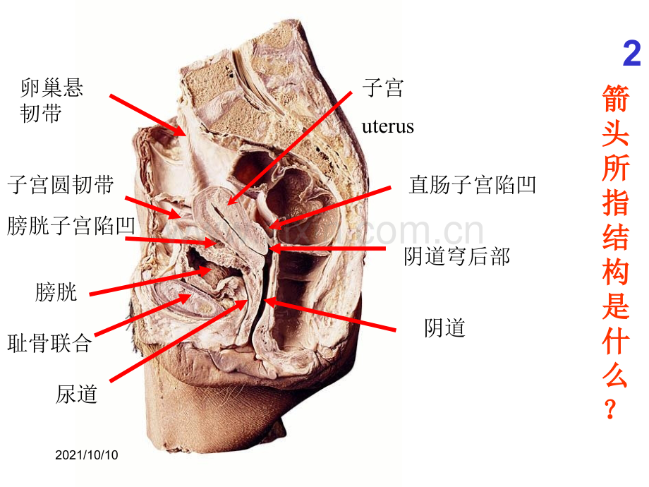 系统解剖学-实验考试题全集.ppt_第2页