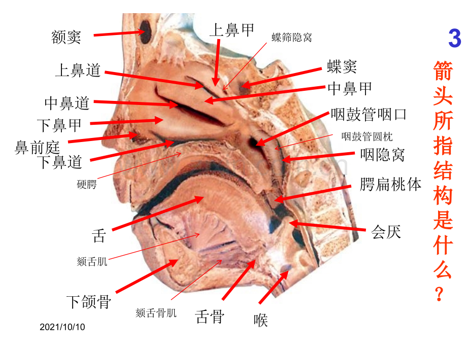 系统解剖学-实验考试题全集.ppt_第3页