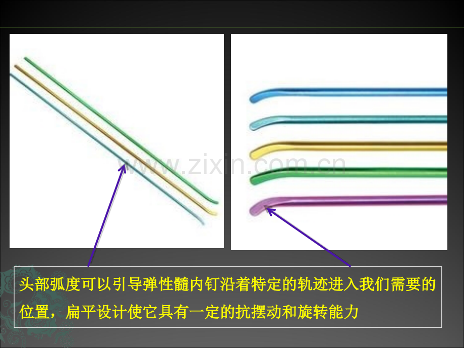 儿童长骨骨折弹性髓内钉课件.ppt_第3页