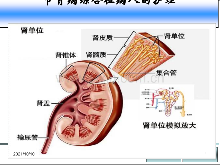 肾病综合征PPT.ppt_第1页