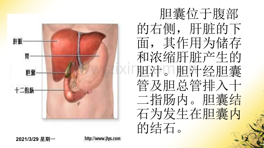 胆囊结石护理查房.ppt_第2页