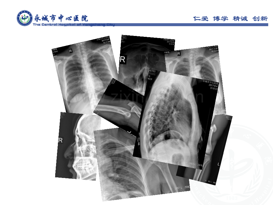 读懂X线胸部平片.ppt_第2页