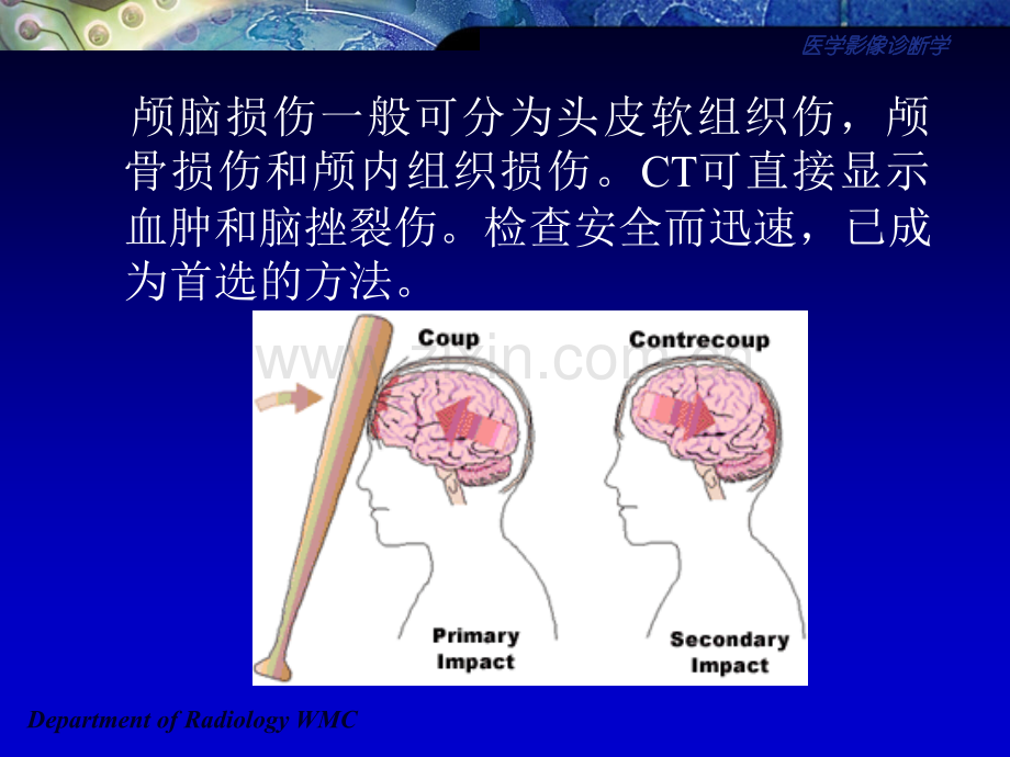 医学影像诊断学颅脑篇.pptx_第2页