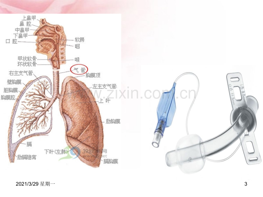 气管切开护理常规(最终).ppt_第3页