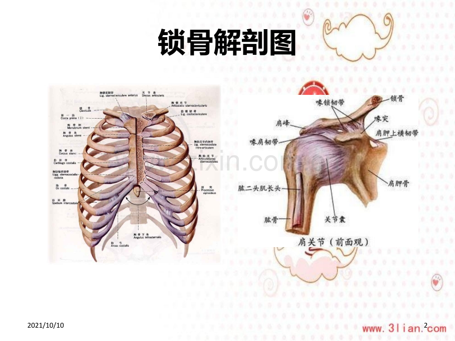 锁骨骨折护理查房.ppt_第2页