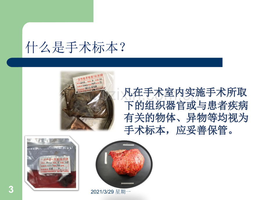 手术室标本管理.ppt_第3页