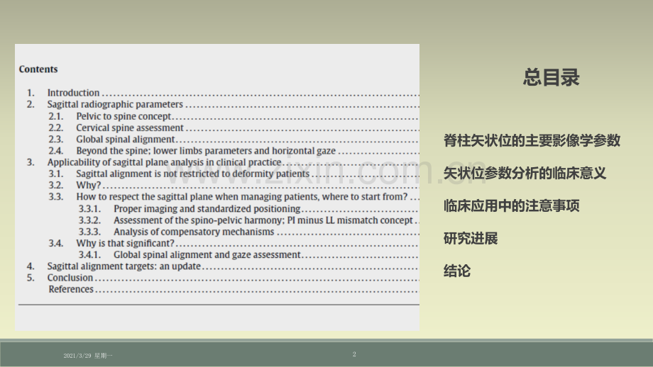 脊柱矢状位影像学参数及临床意义.ppt_第2页