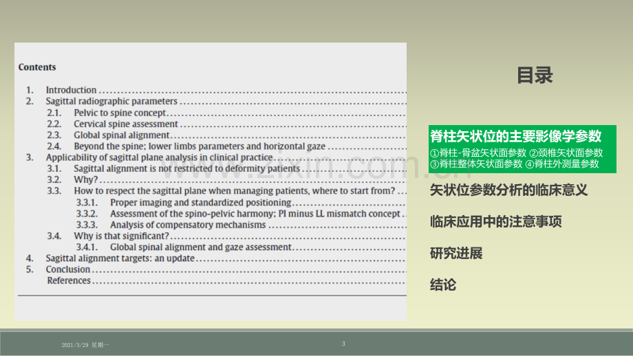 脊柱矢状位影像学参数及临床意义.ppt_第3页