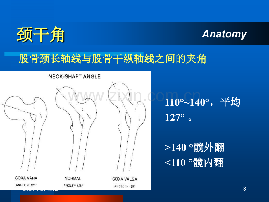 股骨颈骨折.ppt_第3页