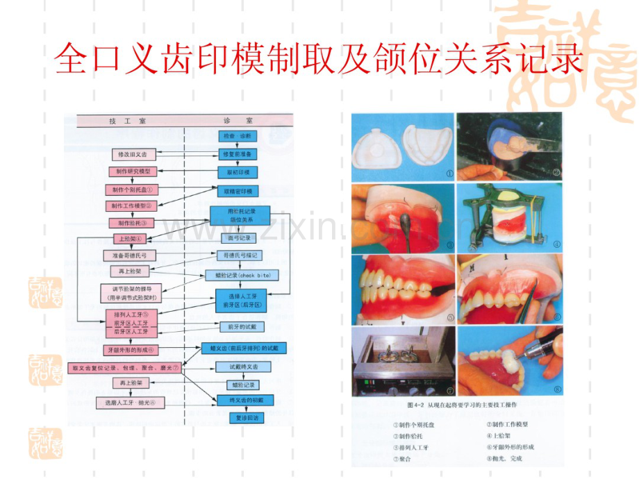 第二部分全口义齿印模制取及颌位关系记录.pdf_第2页