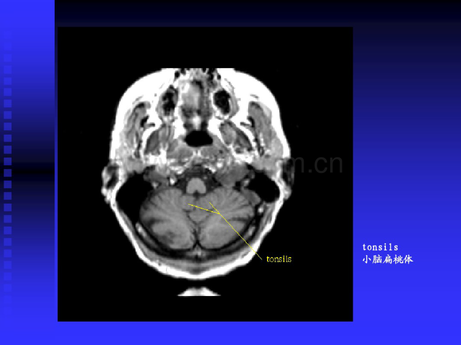 颅脑磁共振影像辨识.pdf_第2页