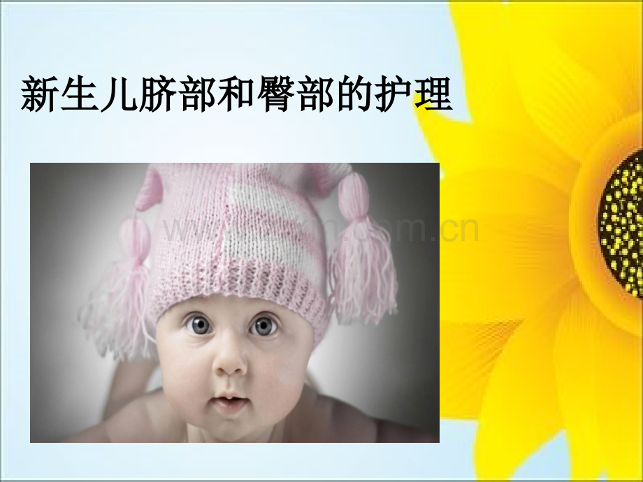 新生儿脐部护理和臀部.ppt_第1页