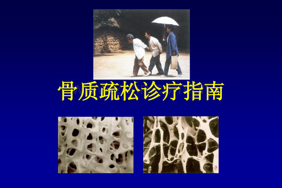 原发性骨质疏松症诊治指南.pdf_第1页