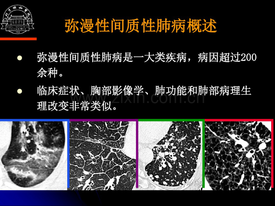 弥漫性间质性肺病诊断思路.pdf_第2页