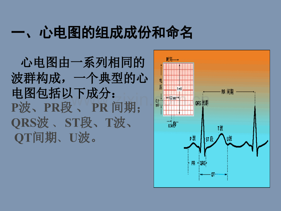 常见异常心电图的识别及药物应用.pptx_第3页