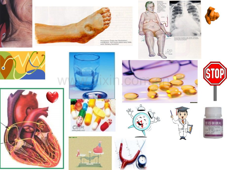 医学小插图.pptx_第3页