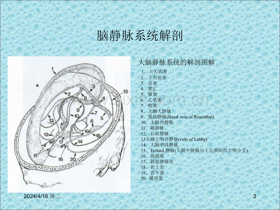 颅内静脉窦血栓形成.ppt_第3页