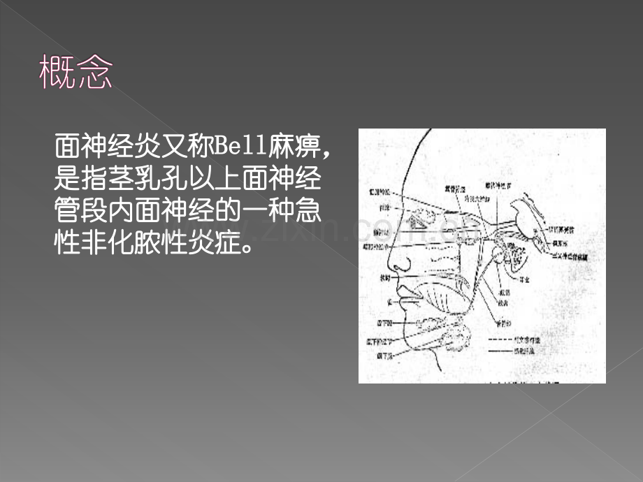 面神经炎查房.ppt_第3页