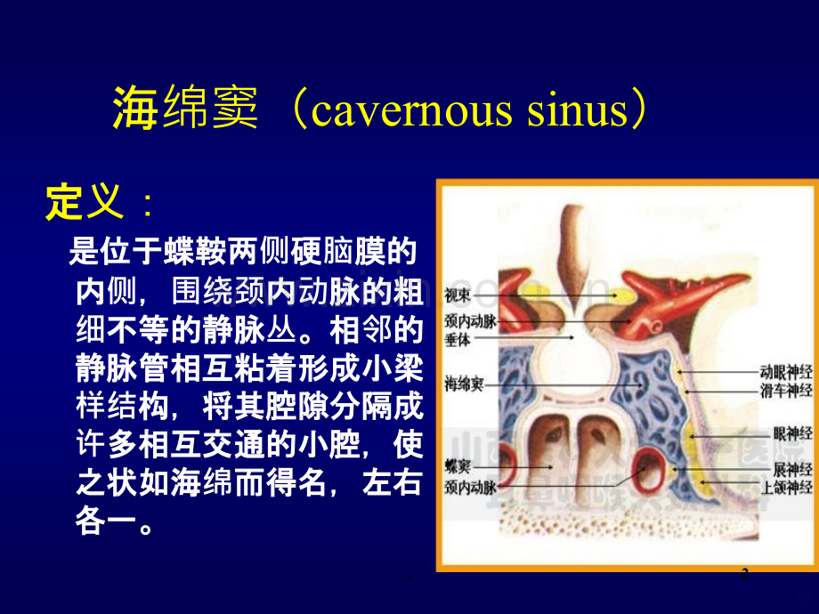 颈动脉海绵窦瘘.ppt_第2页