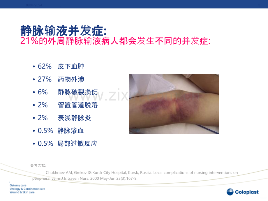 静脉输液的血管保护和周围皮肤护理.ppt_第3页