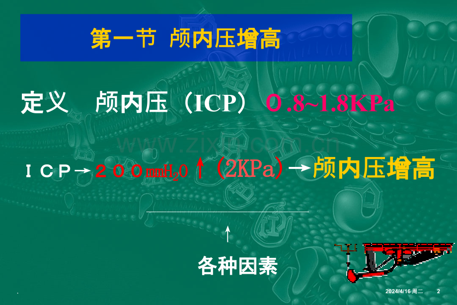 颅内压增高与脑疝.ppt_第2页