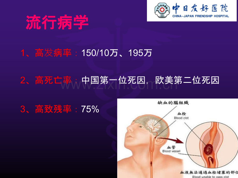 静脉溶栓的护理.ppt_第2页