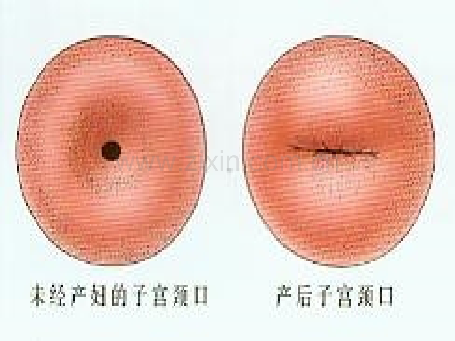 黑龙江医药卫生职业学校护理专业第四章第一节正常产褥期产妇的护理.ppt_第3页