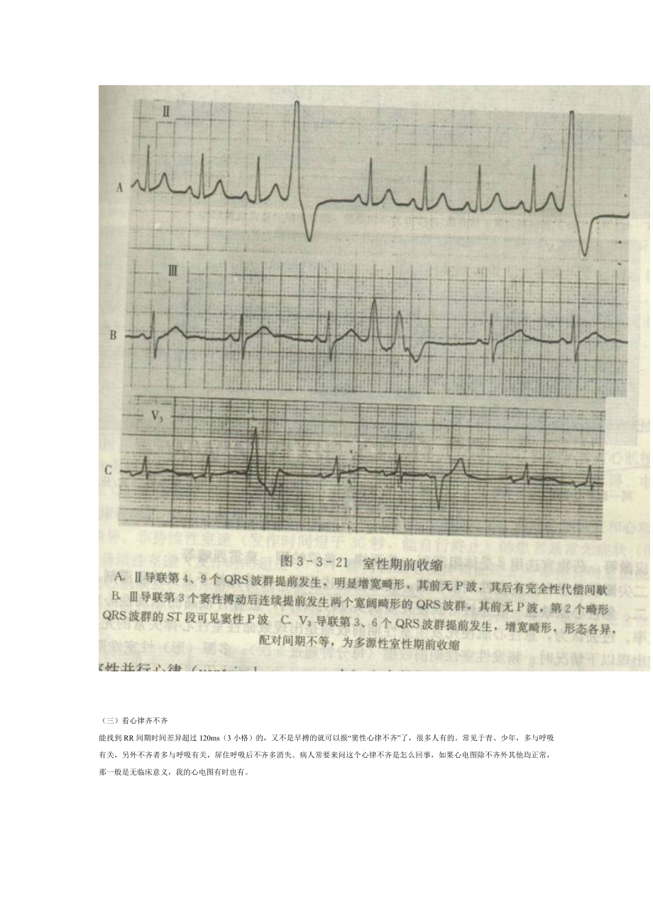 如何阅读心电图报告.doc_第3页