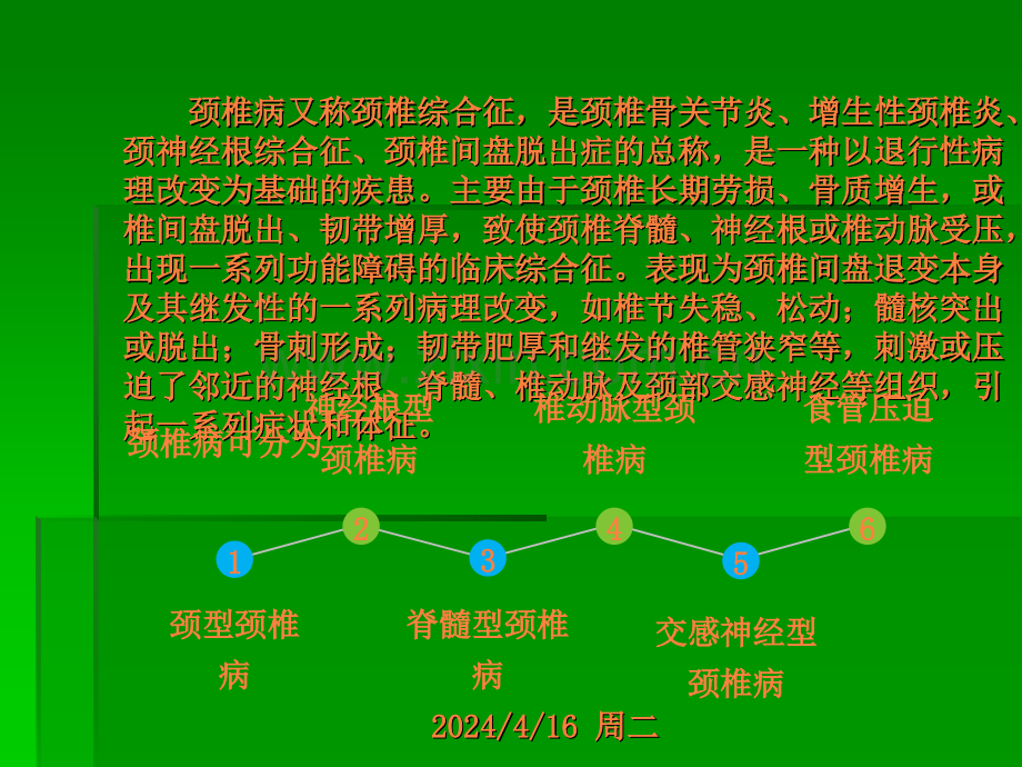 颈椎病健康常识.ppt_第3页