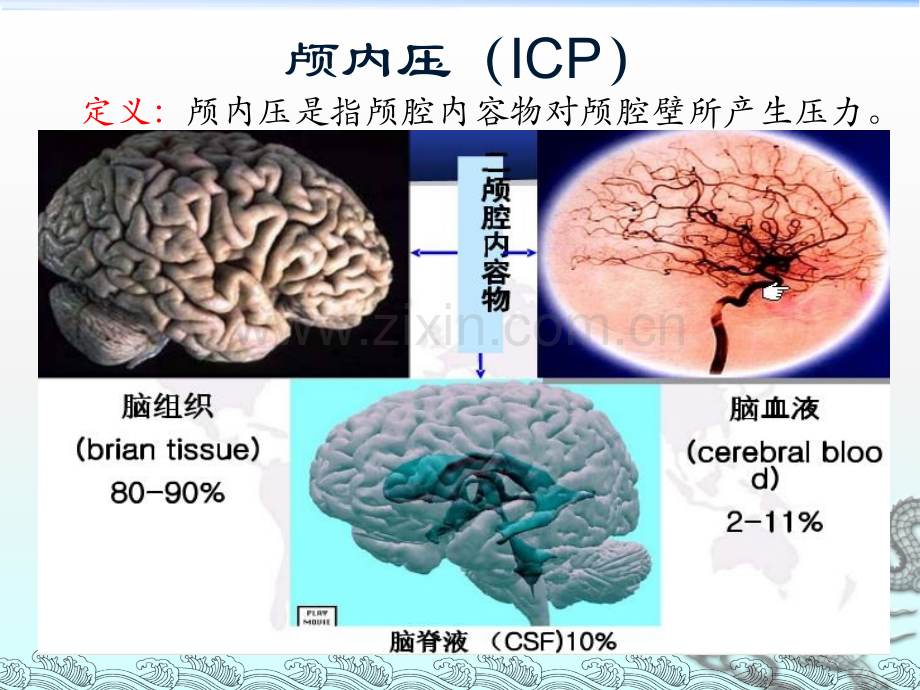 颅内压增高病人的护理-.ppt_第2页