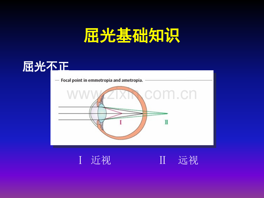 青少年近视眼防控.ppt_第2页