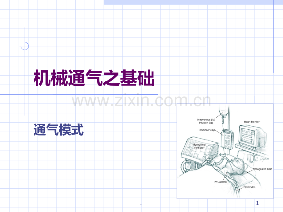 呼吸机模式.ppt_第1页