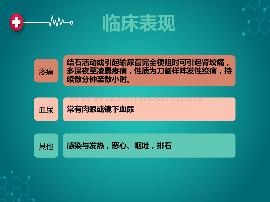 上尿路结石的护理.ppt_第3页