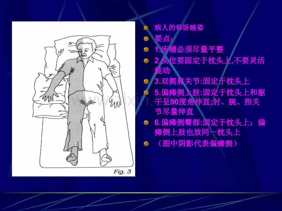 偏瘫患者肢体功能位护理.ppt_第2页