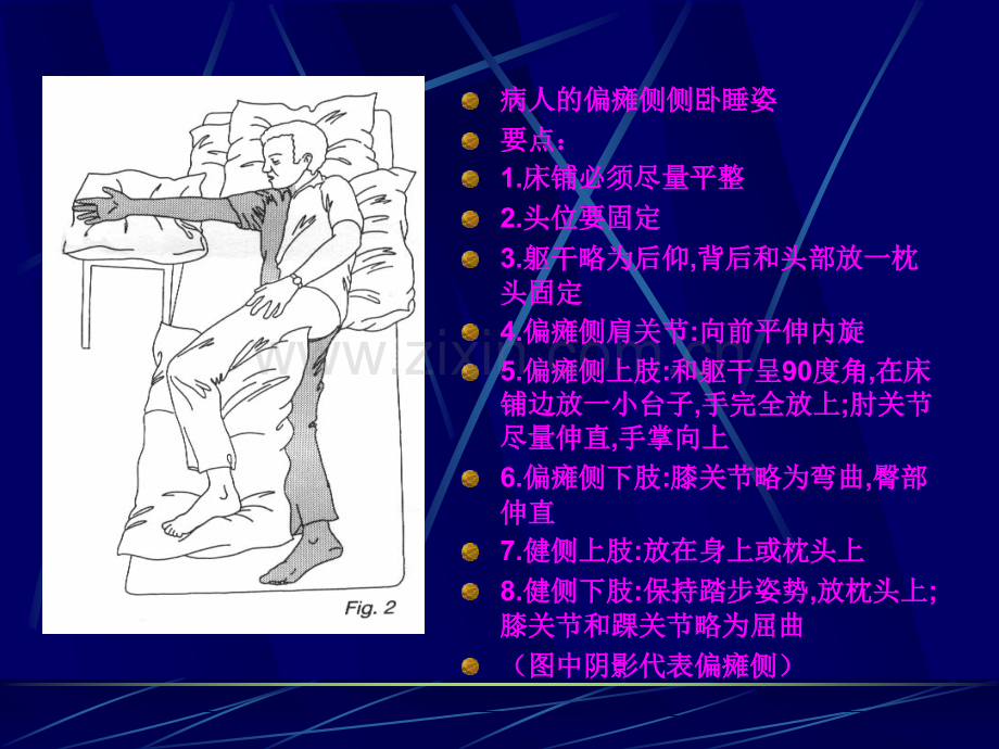 偏瘫患者肢体功能位护理.ppt_第3页