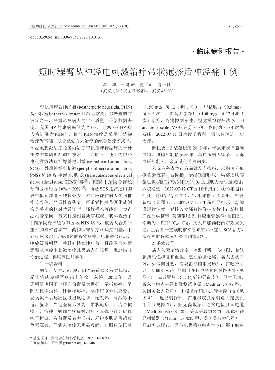 短时程臂丛神经电刺激治疗带状疱疹后神经痛1例.pdf_第1页