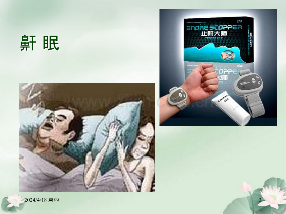 鼾眠、夜惊中医药治疗指南.ppt_第3页