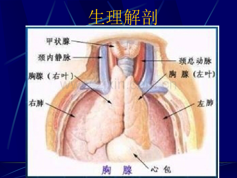 三病区纵膈肿瘤查房.ppt_第3页