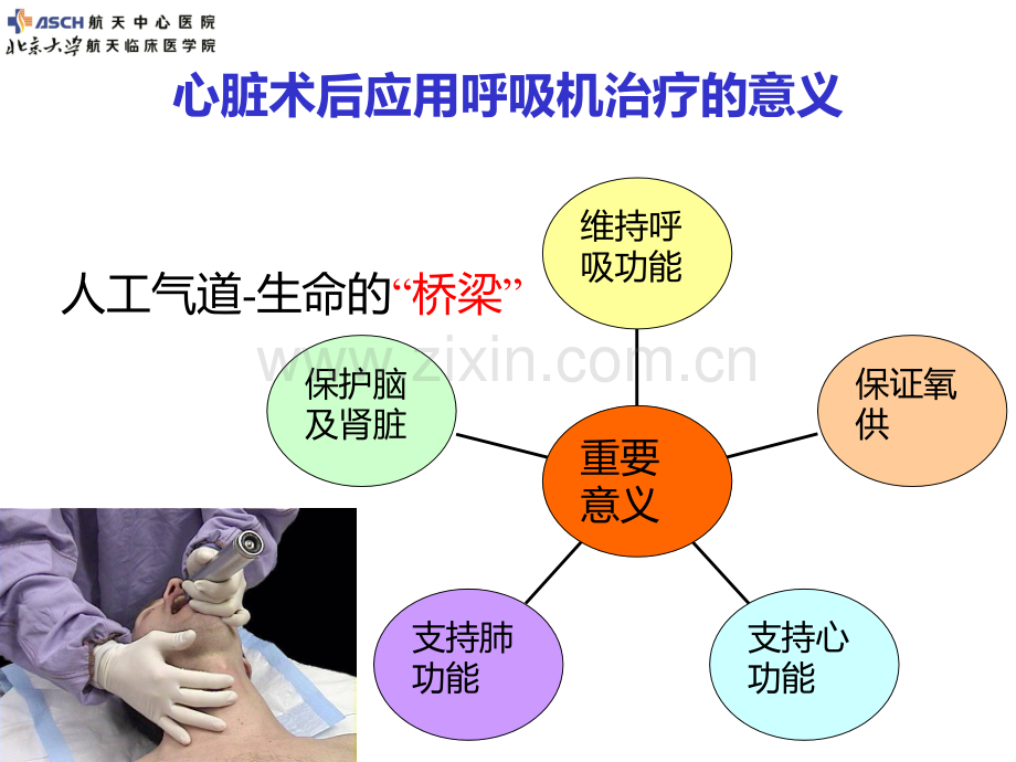 呼吸机拔管流程新.ppt_第3页