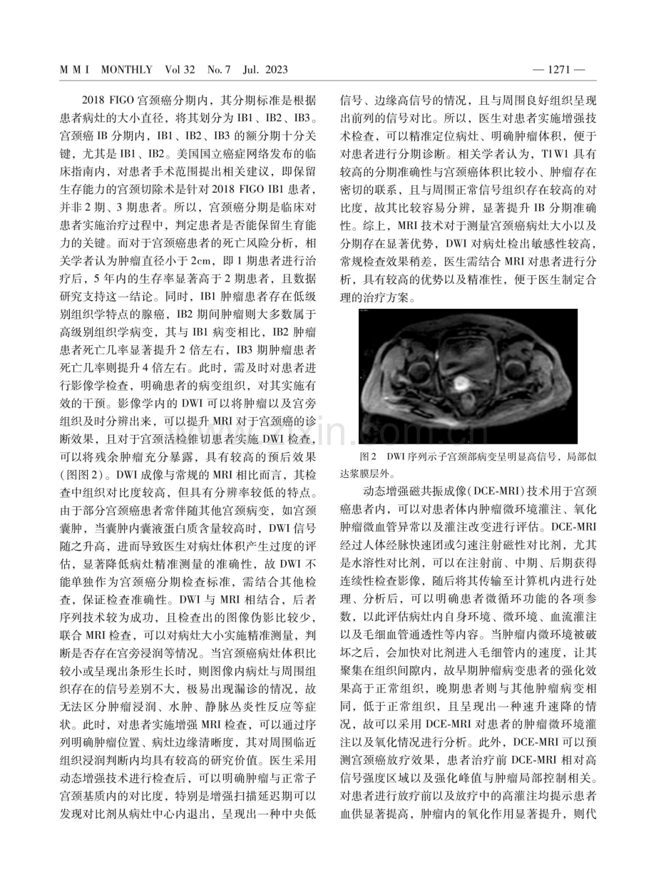 动态增强MRI对宫颈癌诊断的临床价值及准确性分析.pdf_第3页