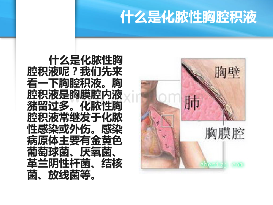 化脓性胸腔积液.ppt_第2页