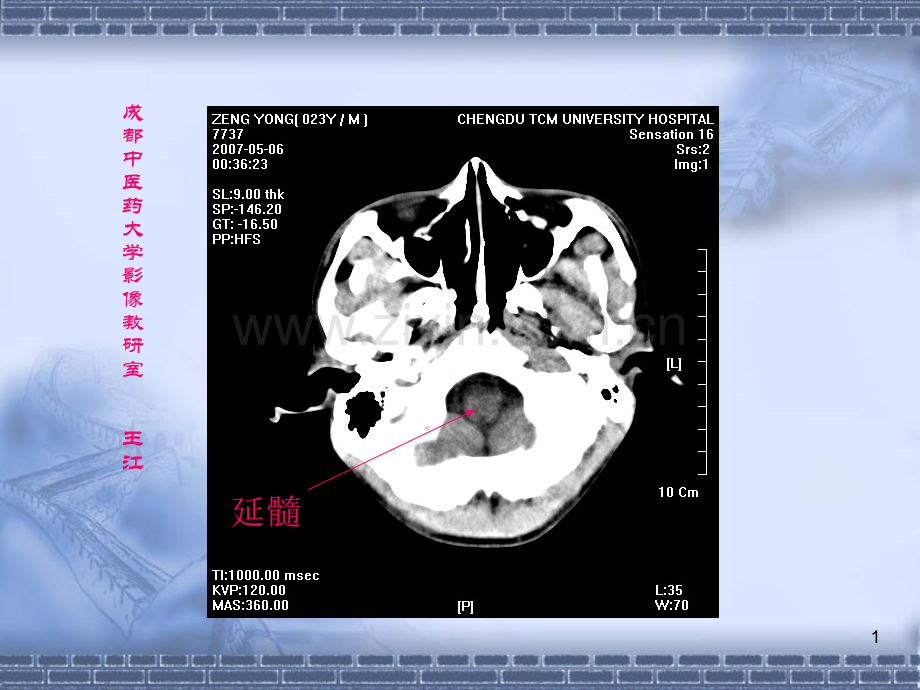 颅脑CT影像学-.ppt_第1页